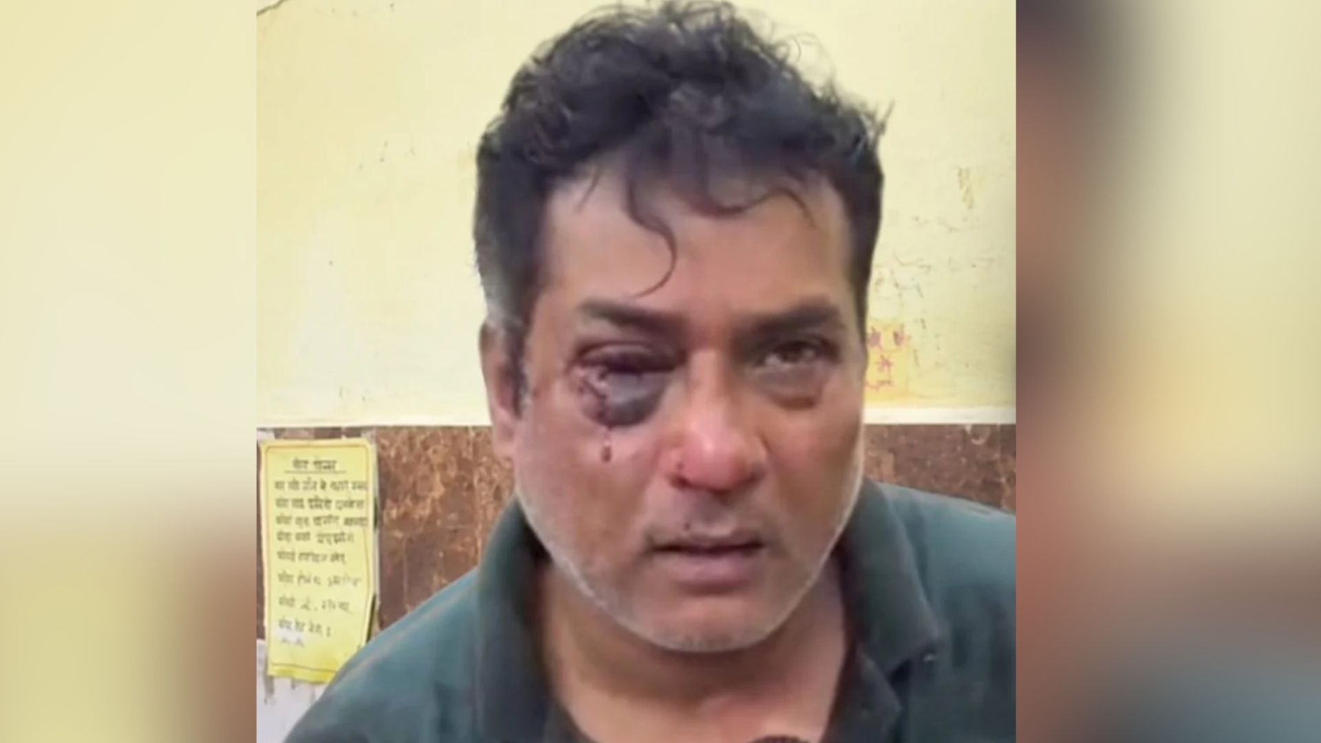 Ambikapur News: कांग्रेस नेता के घर घुसकर जानलेवा हमला, 15-20 बदमाशों ने की मारपीट; भाजपा नेता पर आरोप
